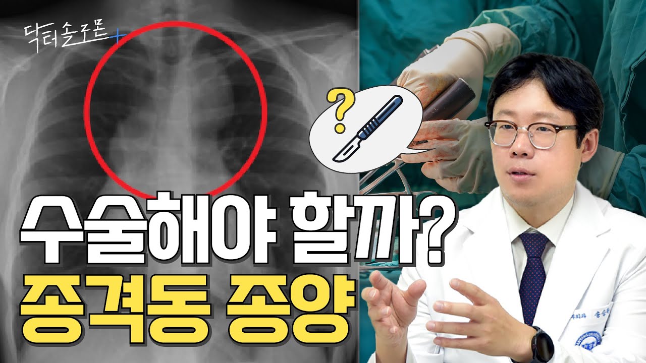 "뭐가 보이네요?" 종격동 종양, 수술해야 할까? 증상도 함께 확인하세요!